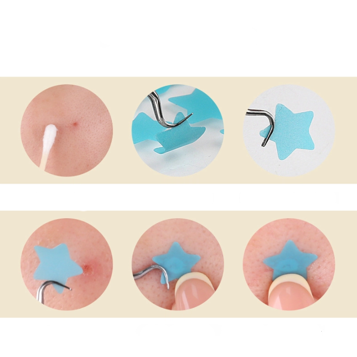 Plastry naklejki na trądzik krosty pryszcze 216 szt hydrokoloidowe