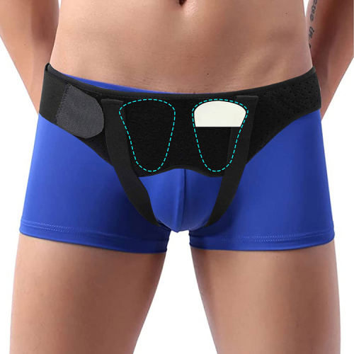 Pas przepuklinowy pooperacyjny pachwinowy przepuklina jednostronna obustronna