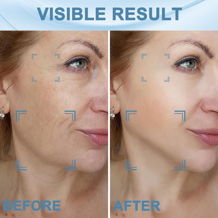 Masażer soniczny EMS do twarzy i szyi LED – lifting, ujędrnianie i regeneracja skóry