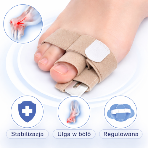 Wspornik na palce – stabilizacja i ulga.png