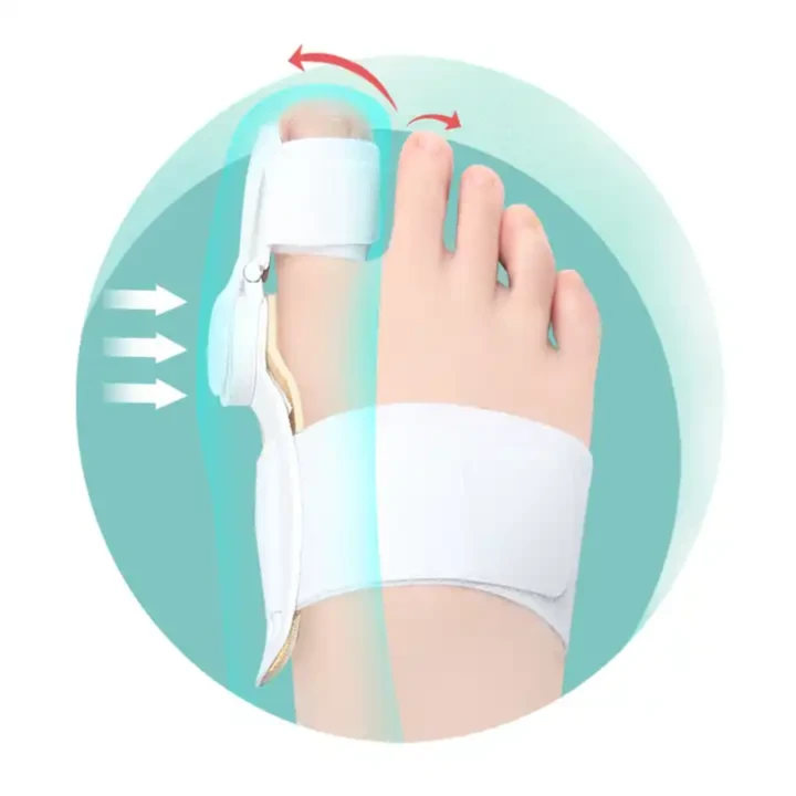 Aparat dynamiczny na haluksy – medyczny korektor palucha z regulacją