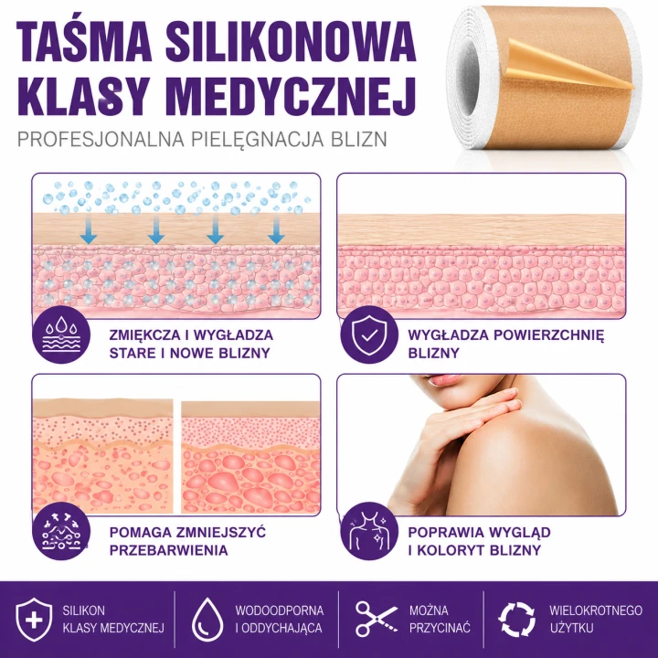 Silikonowa taśma na blizny medyczna wielokrotnego użytku – plaster silikonowy na blizny pooperacyjne i pourazowe