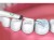 pol_pl_Skaler-dentystyczny-ultradzwiekowy-do-kamienia-2871_7.jpg